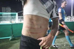galo